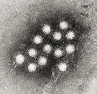 s_200px-Hepatitis_A_virus_02